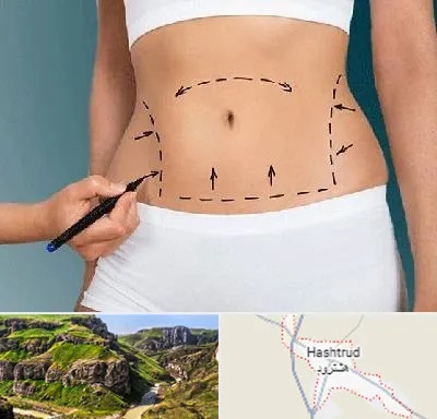 دکتر طب سنتی برای لاغری در هشترود