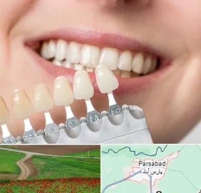 مرکز کامپوزیت دندان در پارس آباد