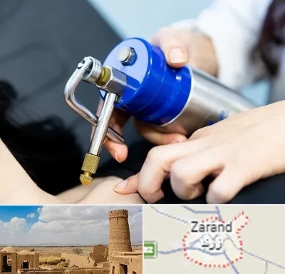 کرایوتراپی در زرند