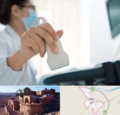 اکوی قلب در قائن