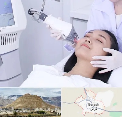وایتنینگ در گراش