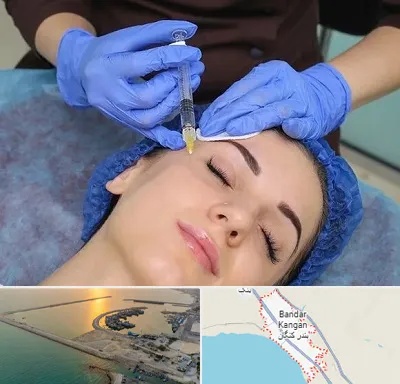 تزریق پروفایلو در بندر کنگان