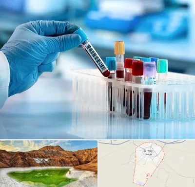 آزمایشگاه خون قبل از ازدواج در گرمسار