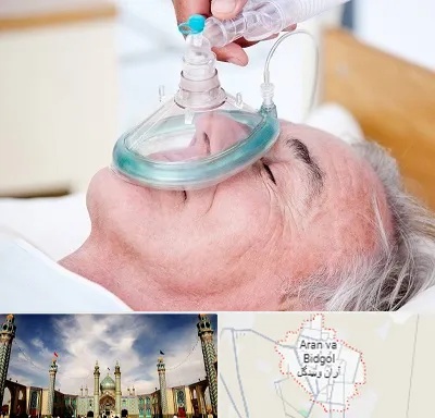 کرایه کپسول اکسیژن در آران و بیدگل