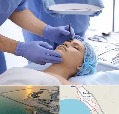 عمل بینی طبیعی در بندر کنگان