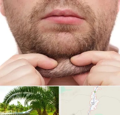 ساکشن غبغب در کهنوج