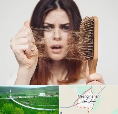 دکتر ریزش مو در مشگین شهر