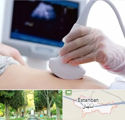سونوگرافی در استهبان