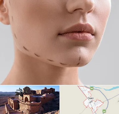 عمل زاویه فک در قائن