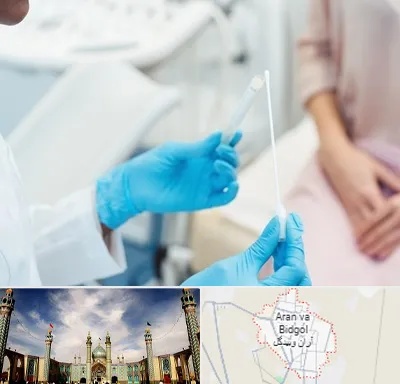 دکتر زگیل تناسلی HPV در آران و بیدگل