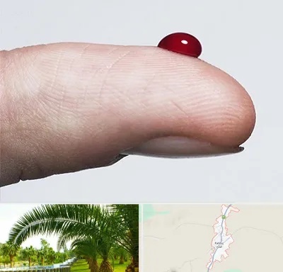 مرکز فصد خون در کهنوج