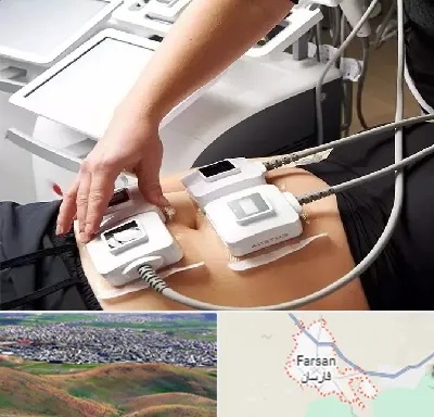 ترواسکالپ در فارسان
