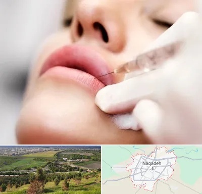 کلینیک تزریق ژل لب در نقده