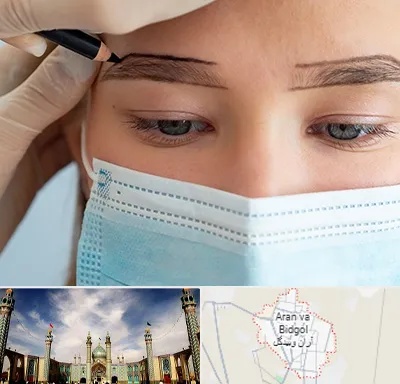 کاشت ابرو در آران و بیدگل