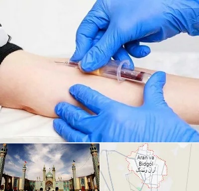 آزمایشگاه ازدواج در آران و بیدگل