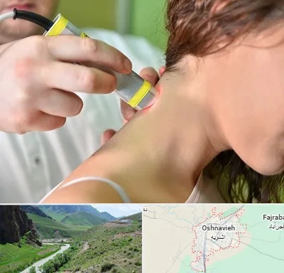 لیزر درمانی در اشنویه