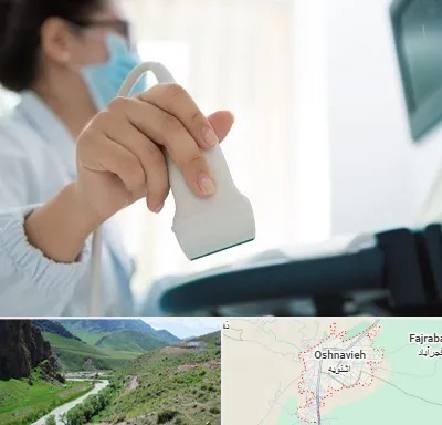 اکوی قلب در اشنویه