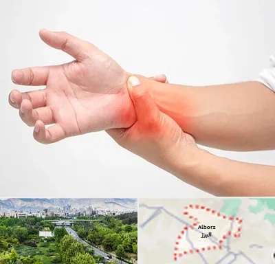 دکتر متخصص دست در البرز
