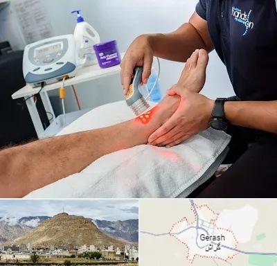 لیزر تراپی در گراش