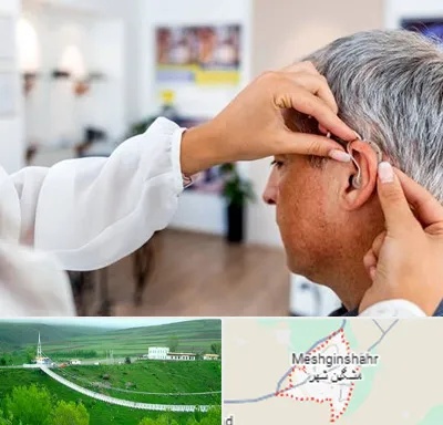 دکتر کم شنوایی در مشگین شهر