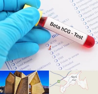 آزمایشگاه بارداری در نی ریز