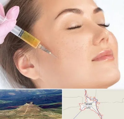 آموزش تزریق ژل و بوتاکس در تکاب