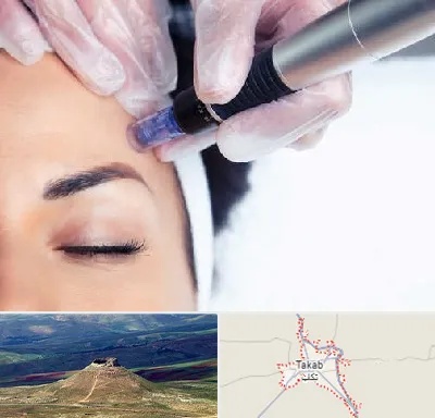 کلینیک مزوتراپی صورت در تکاب