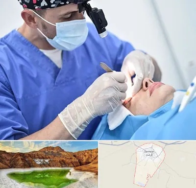 جراح سرطان چشم در گرمسار