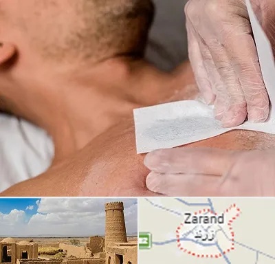 اپیلاسیون آقایان در زرند