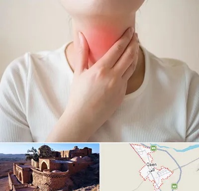 دکتر سرطان مری در قائن