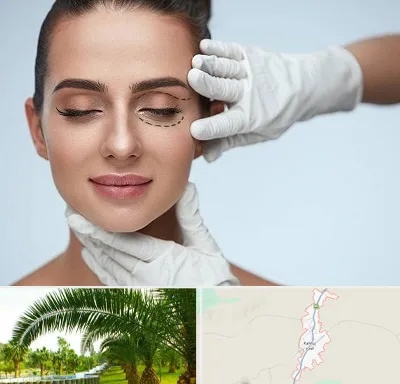 عمل پف چشم در کهنوج