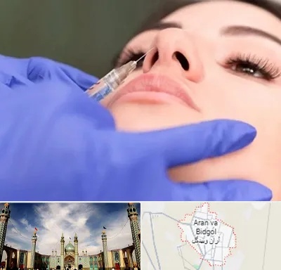 هیالاز در آران و بیدگل