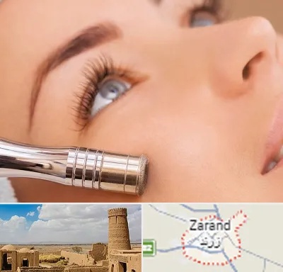میکرودرم در زرند