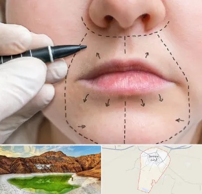 عمل سانترال لب در گرمسار