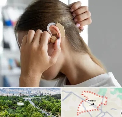 فروش اقساطی سمعک در البرز