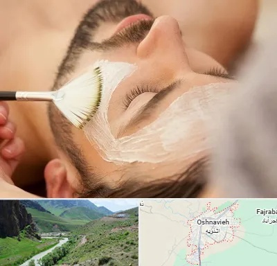 فیشیال صورت آقایان در اشنویه