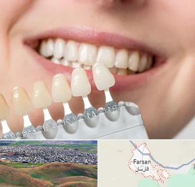 مرکز کامپوزیت دندان در فارسان