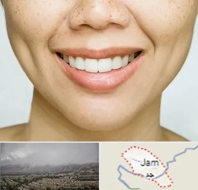 عمل چال گونه در جم