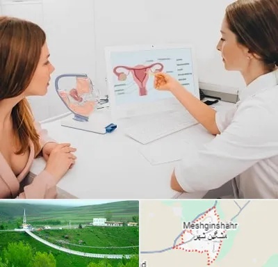 فوق تخصص نازایی در مشگین شهر