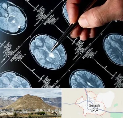 دکتر تشنج در گراش
