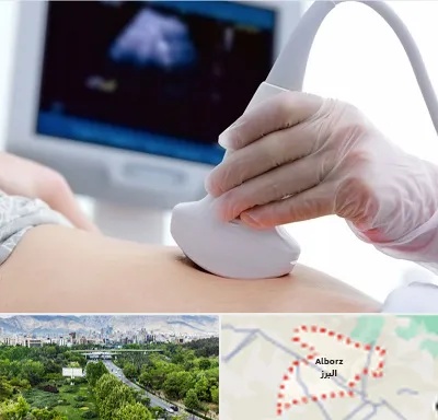 سونوگرافی در البرز