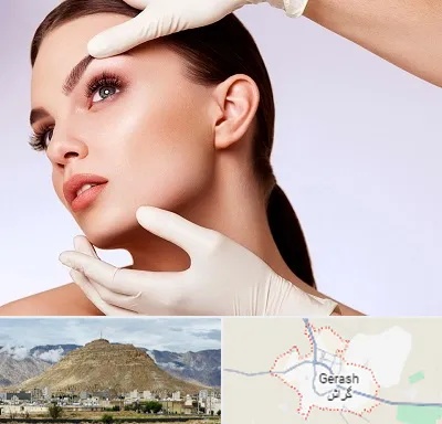 دکتر رفع غبغب در گراش
