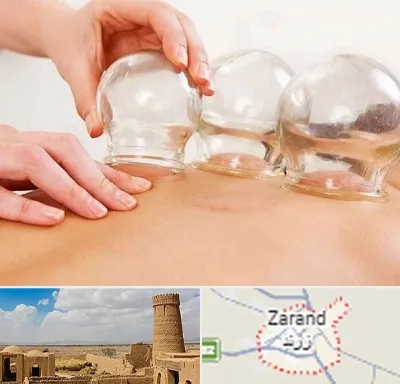 بادکش درمانی در زرند