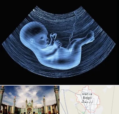 دکتر متخصص غربال گری در آران و بیدگل
