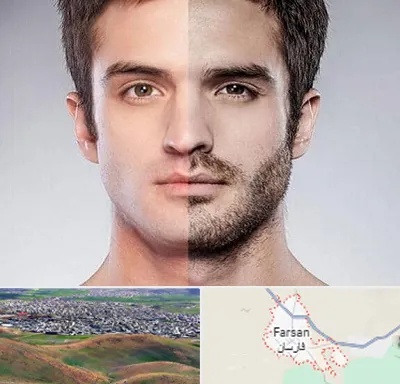 کاشت ریش و سبیل در فارسان