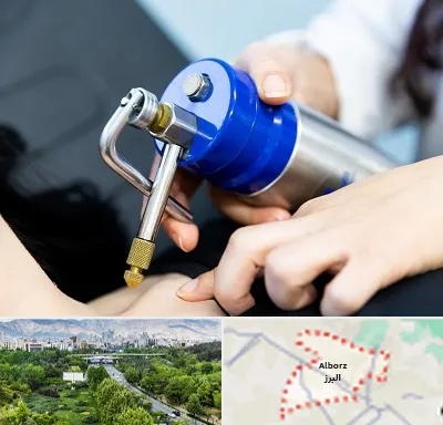 کرایوتراپی در البرز