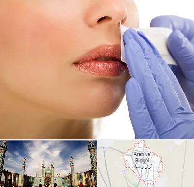 اپیلاسیون صورت در آران و بیدگل