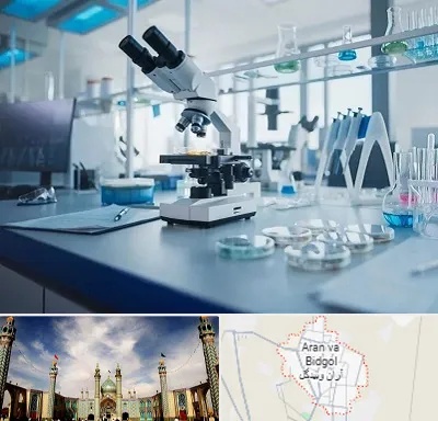 آزمایشگاه تیروئید در آران و بیدگل