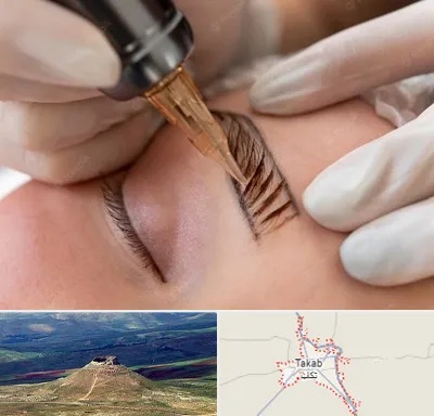 میکروبلیدینگ در تکاب