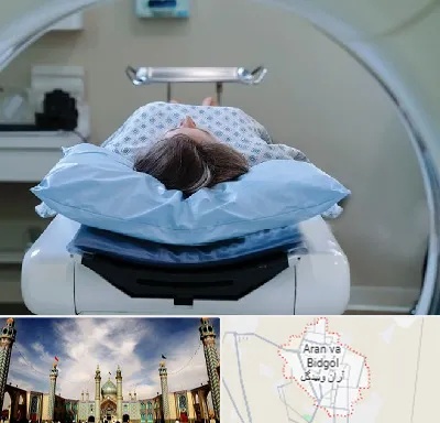 رادیولوژی فک و صورت در آران و بیدگل